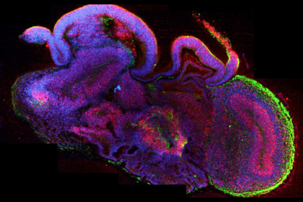 brain organoid lancaster nature2013