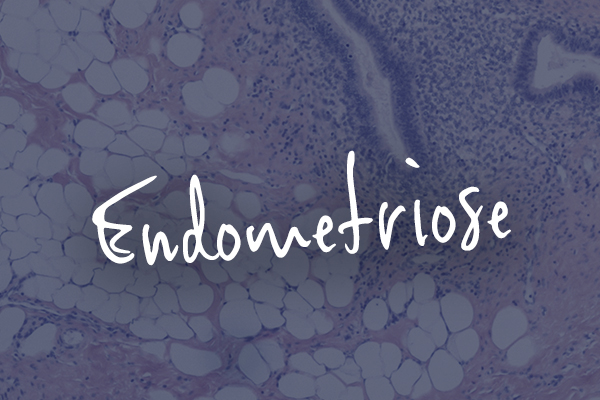 endometriose