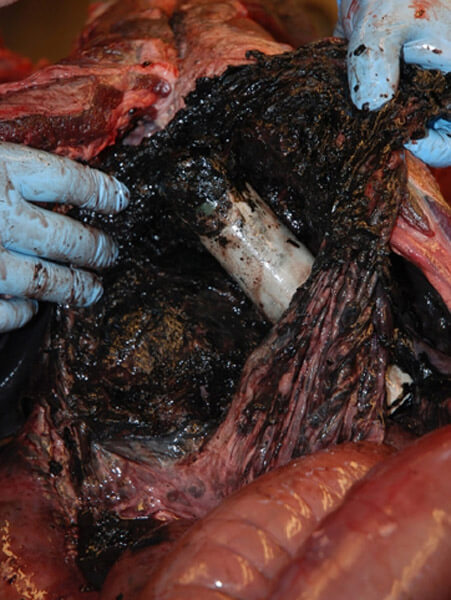 Pathologsiche Veränderungen in der Bauchhöhle eines besenderten Bären en